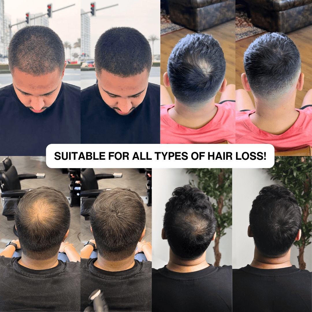Instant Hair Touch-Up for Men & Women - Natural Hairline Coverage