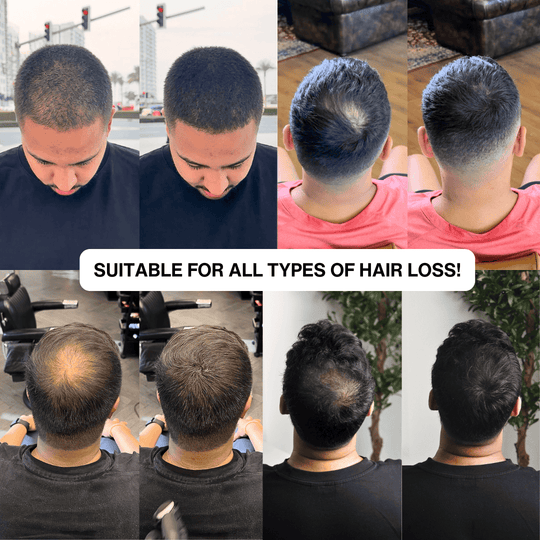 Instant Hair Touch-Up for Men & Women - Natural Hairline Coverage