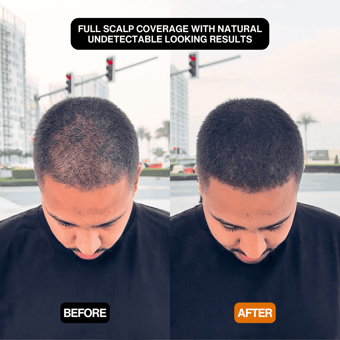 Instant Hair Touch-Up for Men & Women - Natural Hairline Coverage