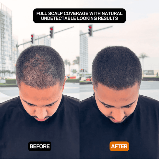 Instant Hair Touch-Up for Men & Women - Natural Hairline Coverage
